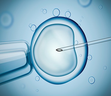 IVF Treatment